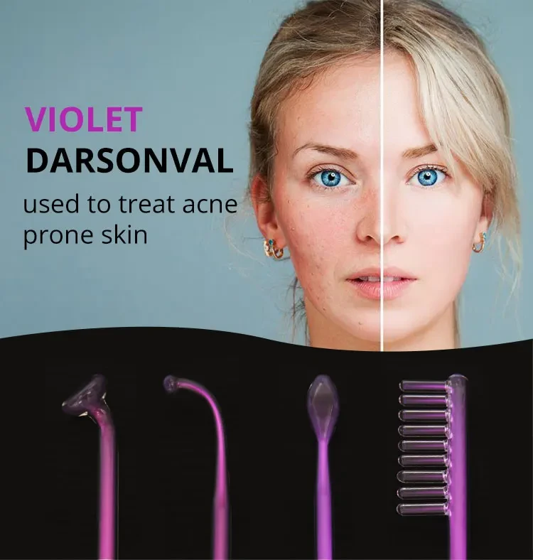 argon gas violet light skin treatment