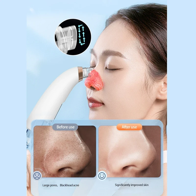 electric suction device for blackhead removal