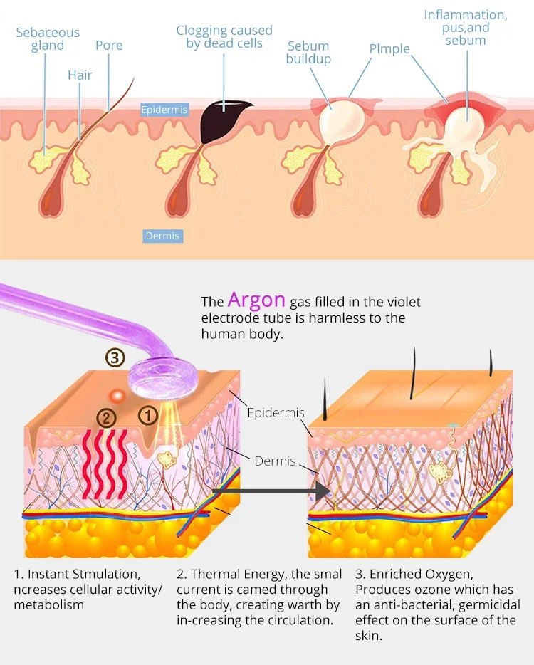 high frequency facial machine for skin care